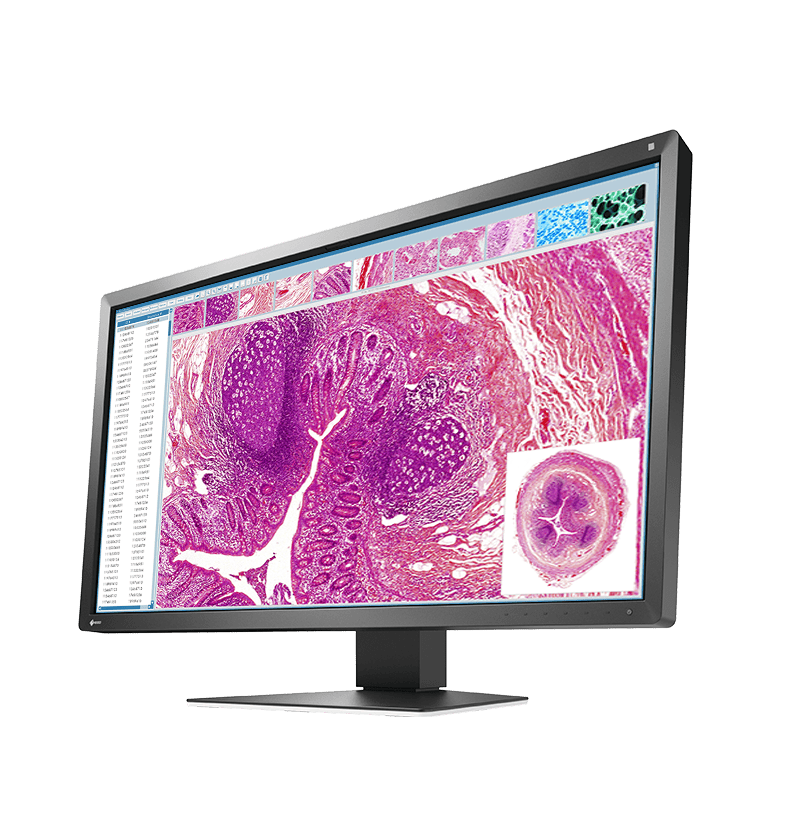Eizo Radiforce MX317W (MX317W) thumbnail