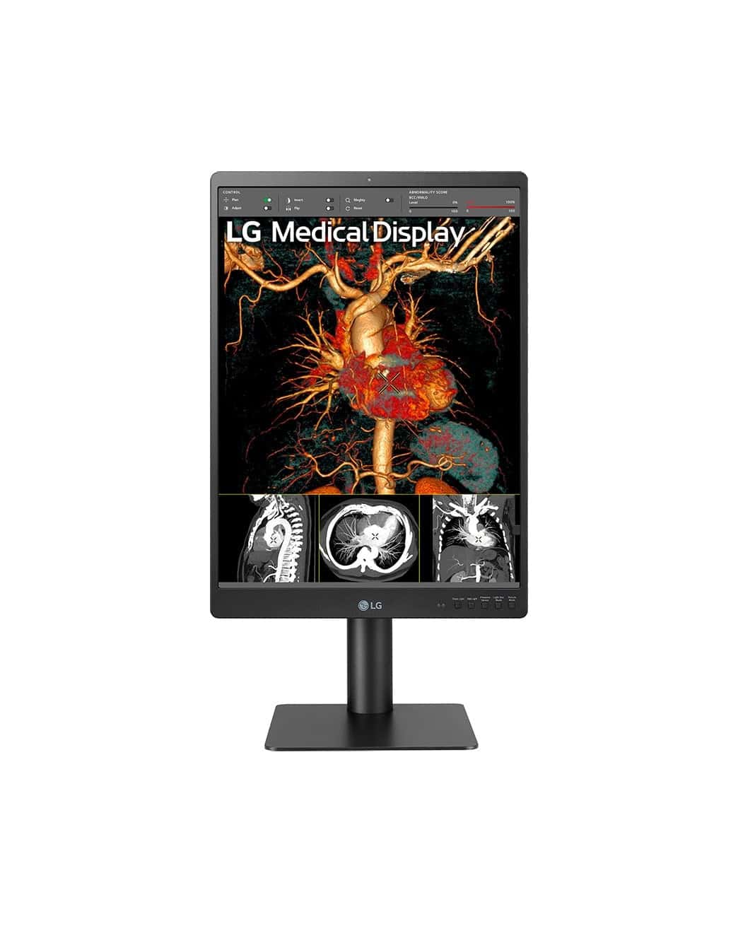 LG 21HQ513D-B/21'' Grayscale 3MP computer monitor 54,1 cm (21.3") 1536 x 2048 Pixels HD LCD Zwart (21HQ513D-B) thumbnail