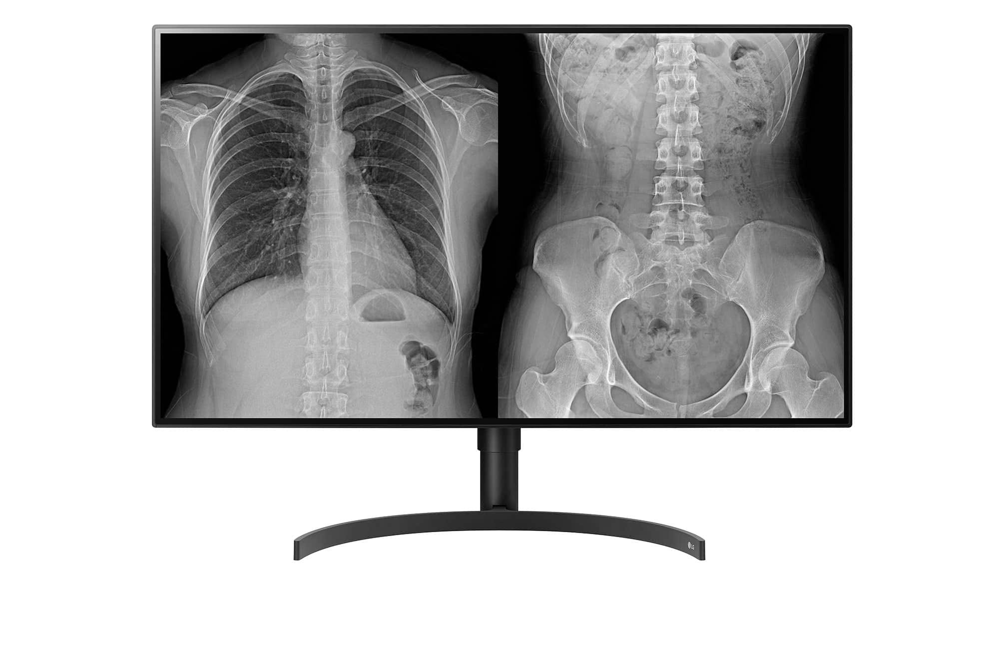 LG 32HL512D-M.AEU (32HL512D-M.AEU) thumbnail