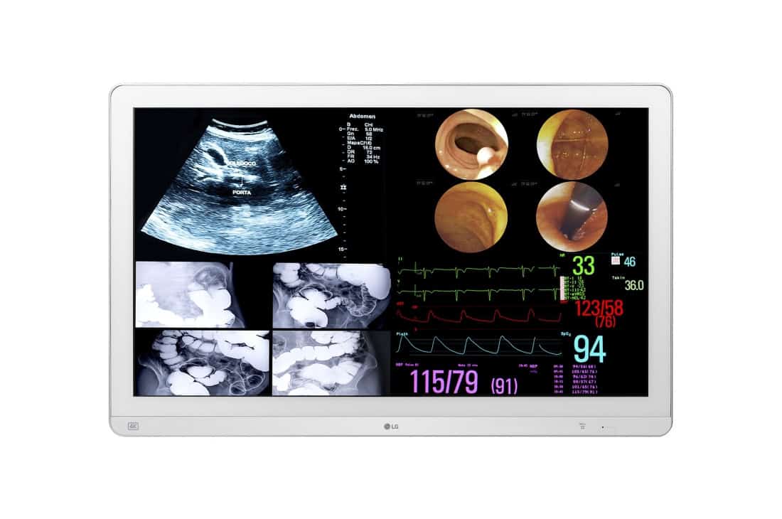 LG 32HL714S-W computer monitor 80 cm (31.5") 3840 x 2160 Pixels 4K Ultra HD Wit (32HL714S-W) thumbnail