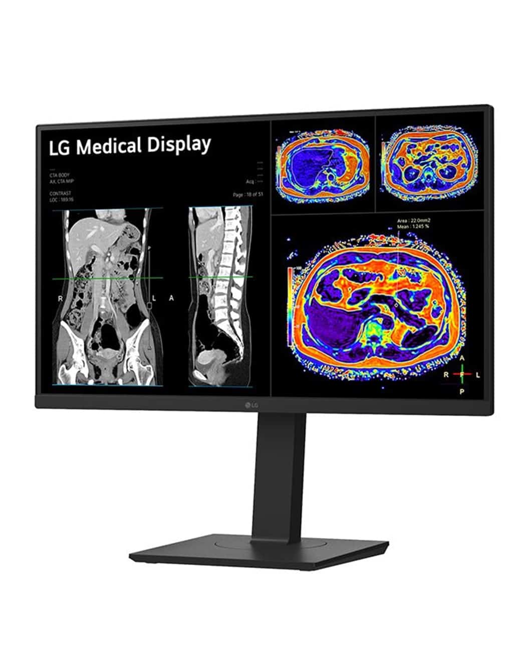 LG Clinical Display 27-inch (16:9) | IPS 8MP (3 840 x 2 160) (27HS713C-B.AEU) thumbnail