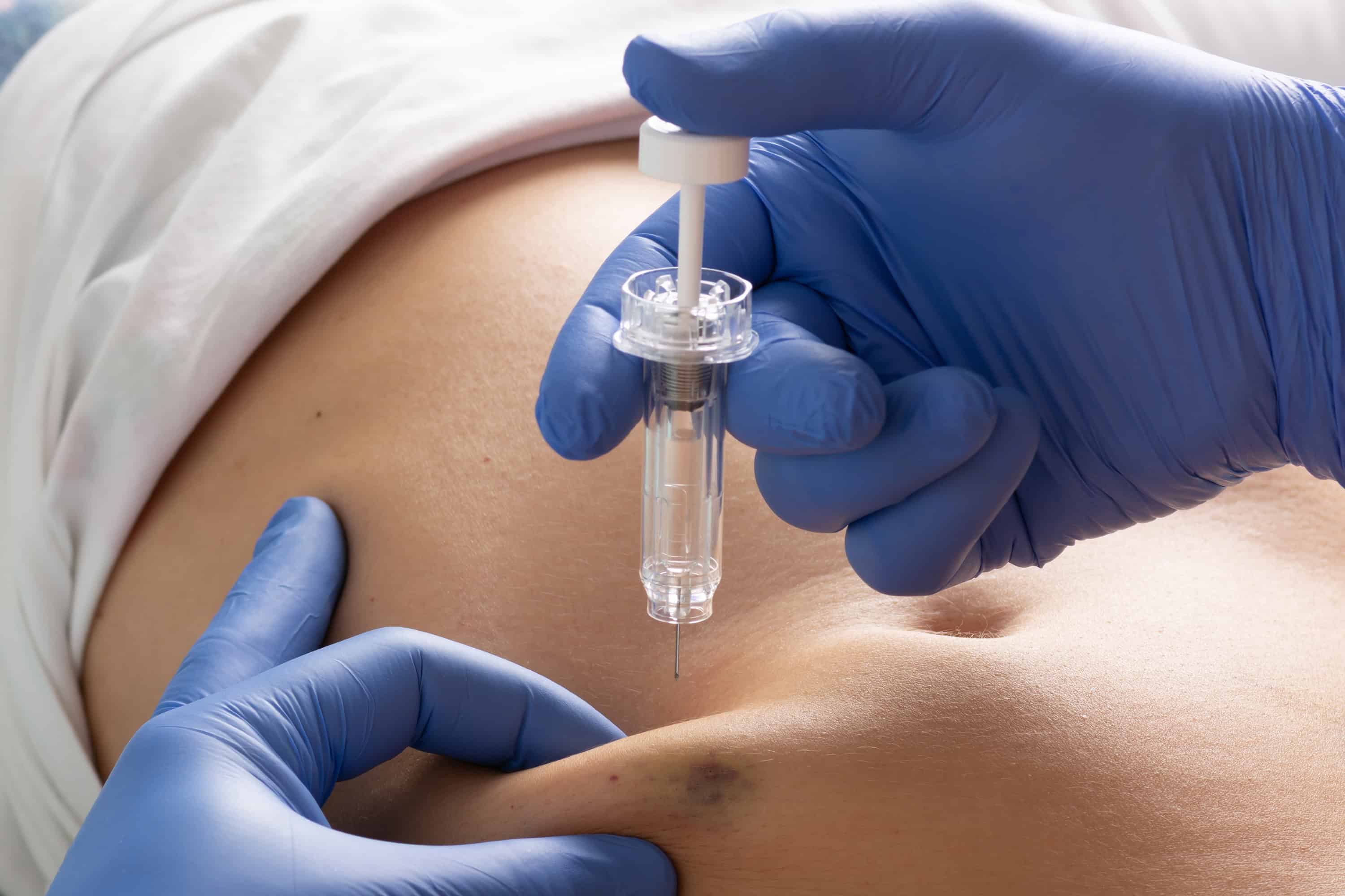 HP 2520-24G-PoE Switch (J9299-69001-RFB) thumbnail