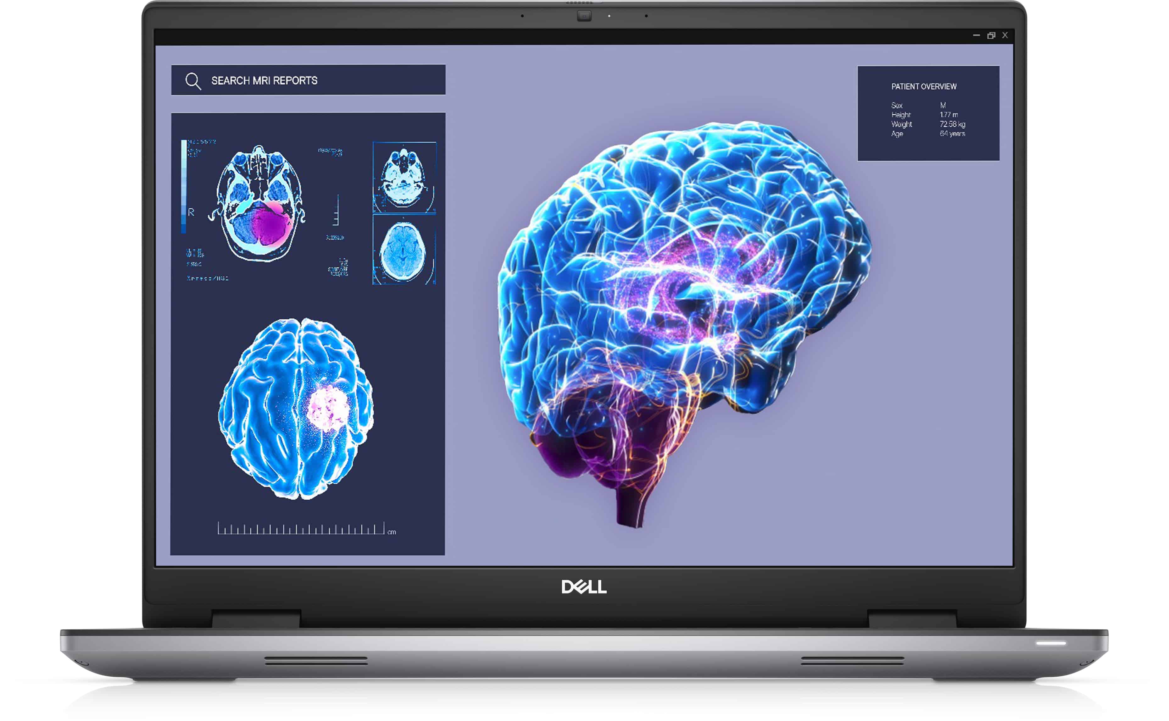 DELL Precision 7680 i7-13850HX Mobiel werkstation 40,6 cm (16) Full HD+ Intel® Core™ i7 32 GB DDR5-SDRAM 1000 GB SSD NVIDIA RTX 3500 Wi-Fi 6E (802.11ax) Windows 11 Pro Grijs (4W5KH) thumbnail