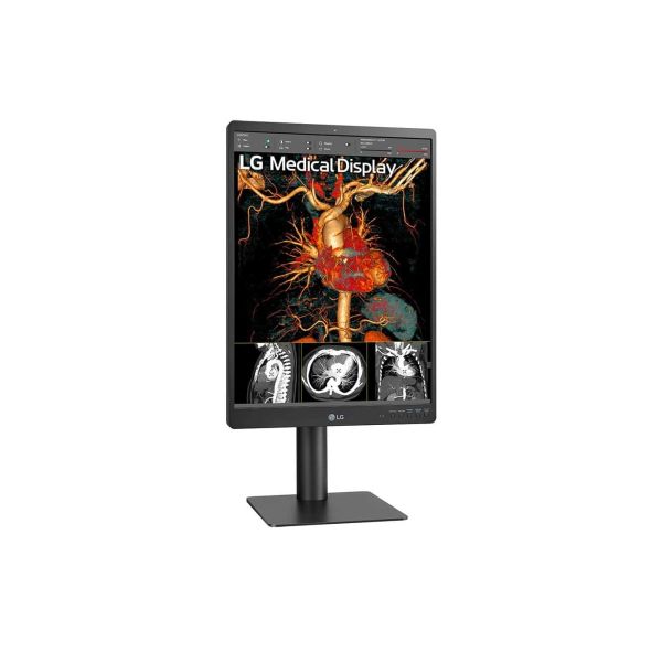 LG 21HQ513D-B/21'' Grayscale 3MP computer monitor 54,1 cm (21.3") 1536 x 2048 Pixels HD LCD Zwart (21HQ513D-B)