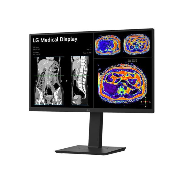 LG Clinical Display 27-inch 4K (27HS713C-B.AEU)