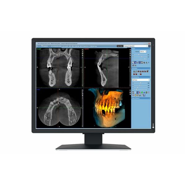 EIZO RadiForce MX217-SB computer monitor 53,3 cm (21") 1200 x 1600 Pixels UXGA LCD Zwart (MX217-SB)