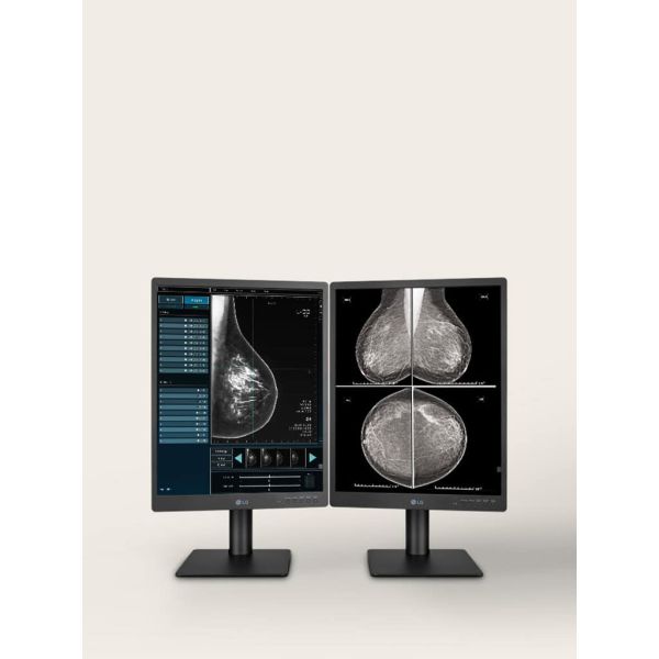 LG Diagnostic Display 21.3 inch IPS 5MP (2048x2560) (21HQ613D-M.AEU)
