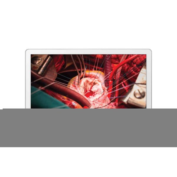 LG 27HK510S computer monitor 68,6 cm (27") 1920 x 1080 Pixels Full HD LED Wit (27HK510S-W.AEU)