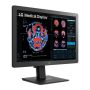 LG 24HR513C-B computer monitor 61 cm (24") 1920 x 1080 Pixels Full HD Zwart (24HR513C-B.AEU) thumbnail