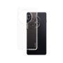 PanzerGlass CARE™ by ® X-Ray Case OnePlus 13R mobiele telefoon behuizingen Hoes Transparant (CRRFAXRG17733) thumbnail