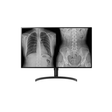 LG 32HL512D-M computer monitor 80 cm (31.5") 3840 x 2160 Pixels Full HD Zwart (32HL512D-M.AEU) thumbnail