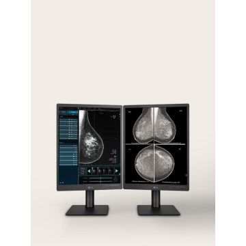 LG Diagnostic Display 21.3-inch 4:5 | (21HQ613D-M.AEU) thumbnail